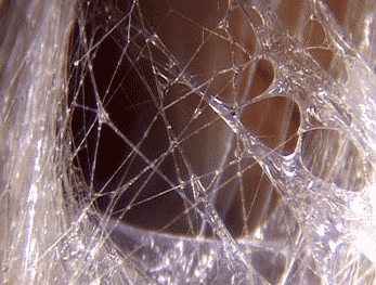 Vue microscopique des fascias montrant leur organisation en filaments, à la manière d'une toile d'araignée